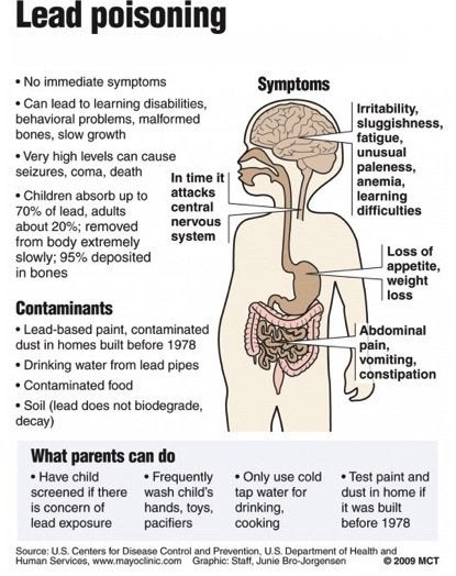  Lead Poisoning, Lead Testing in San Francisco 